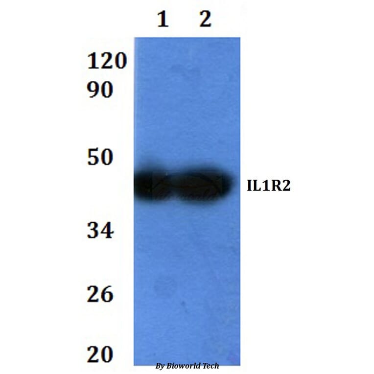 Anti-IL1R2 Antibody from Bioworld Technology (BS60921) - Antibodies.com