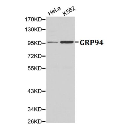Anti-GRP94 Antibody from Bioworld Technology (BS6093) - Antibodies.com