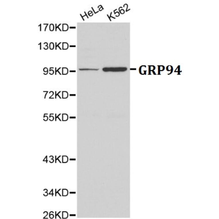 Anti-GRP94 Antibody from Bioworld Technology (BS6093) - Antibodies.com