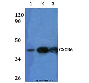 Anti-CXCR6 Antibody from Bioworld Technology (BS60934) - Antibodies.com