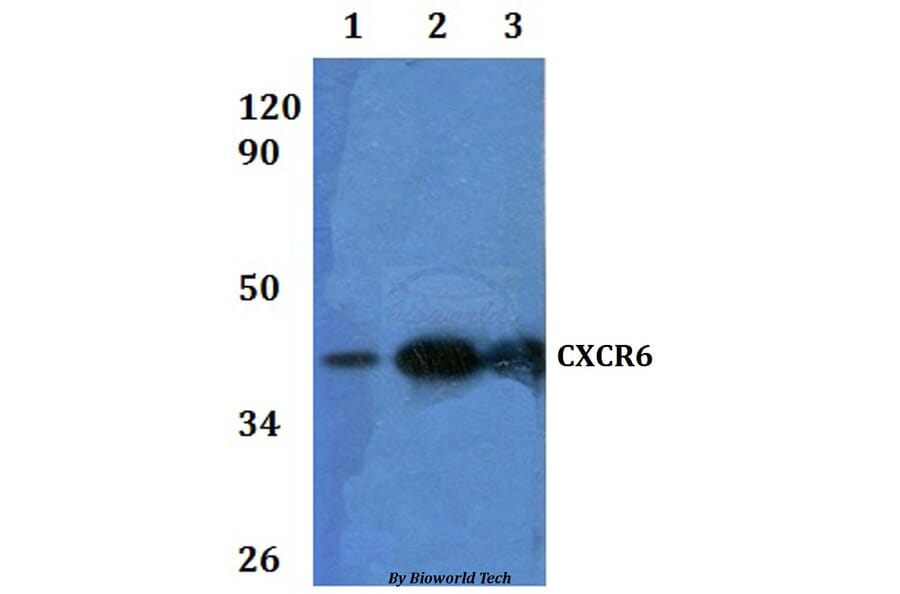 Anti-CXCR6 Antibody from Bioworld Technology (BS60934) - Antibodies.com