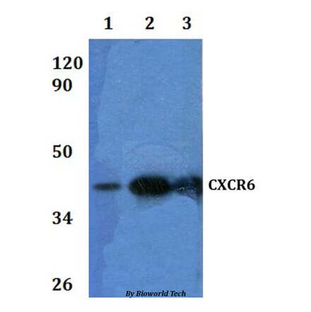 Anti-CXCR6 Antibody from Bioworld Technology (BS60934) - Antibodies.com
