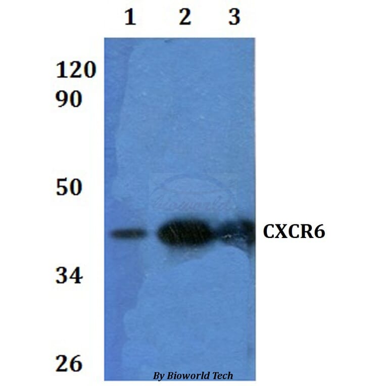 Anti-CXCR6 Antibody from Bioworld Technology (BS60934) - Antibodies.com