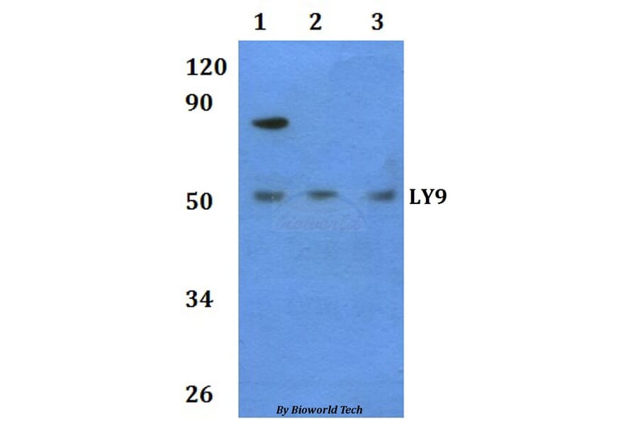 Anti-LY9 Antibody from Bioworld Technology (BS60938) - Antibodies.com