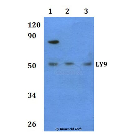 Anti-LY9 Antibody from Bioworld Technology (BS60938) - Antibodies.com