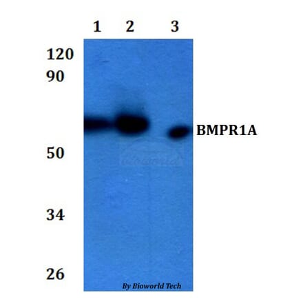 Anti-BMPR1A Antibody from Bioworld Technology (BS60939) - Antibodies.com