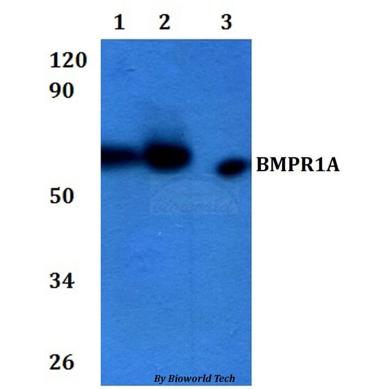 Anti-BMPR1A Antibody from Bioworld Technology (BS60939) - Antibodies.com