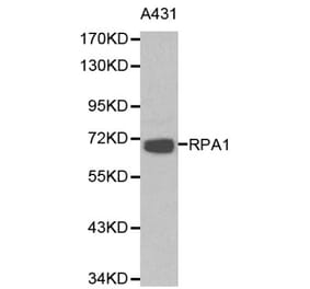Anti-RPA1 Antibody from Bioworld Technology (BS6094) - Antibodies.com