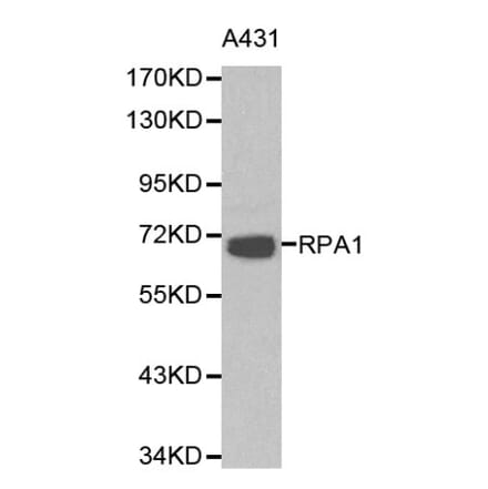 Anti-RPA1 Antibody from Bioworld Technology (BS6094) - Antibodies.com