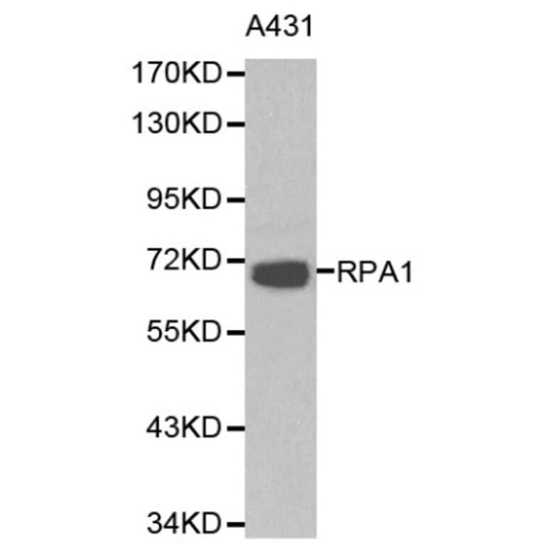 Anti-RPA1 Antibody from Bioworld Technology (BS6094) - Antibodies.com