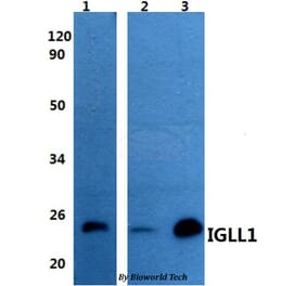 Anti-IGLL1 Antibody from Bioworld Technology (BS60959) - Antibodies.com