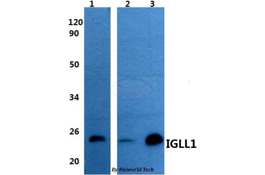 Anti-IGLL1 Antibody from Bioworld Technology (BS60959) - Antibodies.com