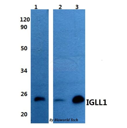 Anti-IGLL1 Antibody from Bioworld Technology (BS60959) - Antibodies.com