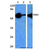 Anti-Frizzled-4 Antibody from Bioworld Technology (BS60963) - Antibodies.com