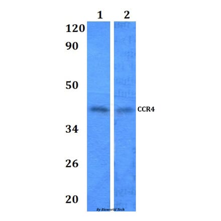 Anti-CCR4 Antibody from Bioworld Technology (BS60964) - Antibodies.com