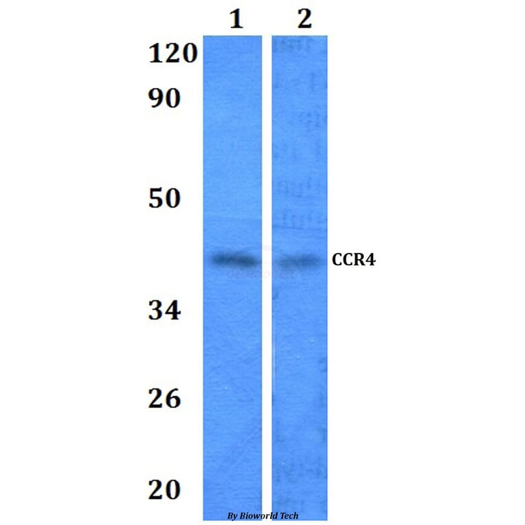 Anti-CCR4 Antibody from Bioworld Technology (BS60964) - Antibodies.com