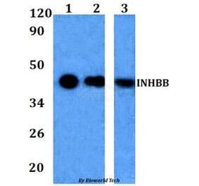 Anti-INHBB Antibody from Bioworld Technology (BS60965) - Antibodies.com