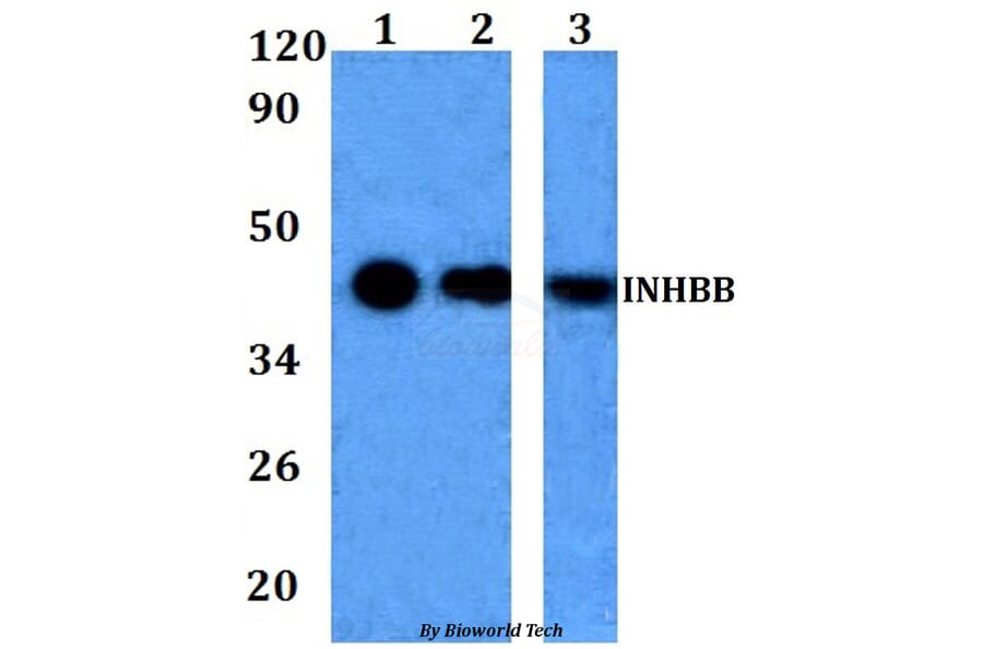 Anti-INHBB Antibody from Bioworld Technology (BS60965) - Antibodies.com