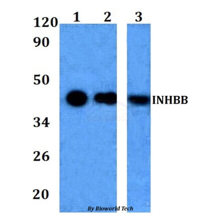 Anti-INHBB Antibody from Bioworld Technology (BS60965) - Antibodies.com
