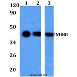 Anti-INHBB Antibody from Bioworld Technology (BS60965) - Antibodies.com