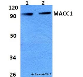 Anti-MACC1 Antibody from Bioworld Technology (BS60966) - Antibodies.com