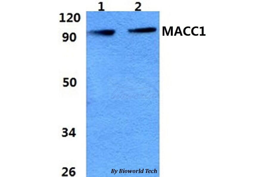 Anti-MACC1 Antibody from Bioworld Technology (BS60966) - Antibodies.com