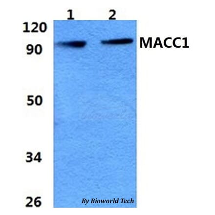 Anti-MACC1 Antibody from Bioworld Technology (BS60966) - Antibodies.com