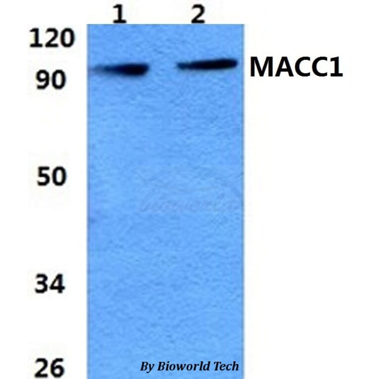 Anti-MACC1 Antibody from Bioworld Technology (BS60966) - Antibodies.com