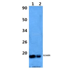 Anti-IL36RN Antibody from Bioworld Technology (BS60972) - Antibodies.com