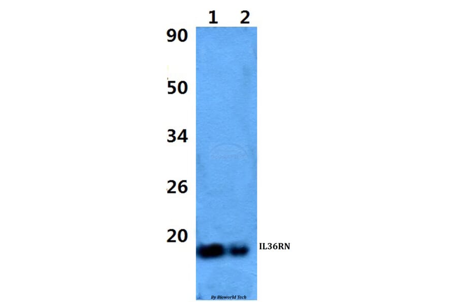 Anti-IL36RN Antibody from Bioworld Technology (BS60972) - Antibodies.com