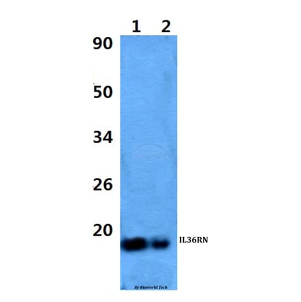 Anti-IL36RN Antibody from Bioworld Technology (BS60972) - Antibodies.com