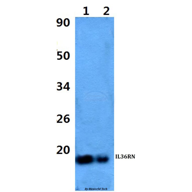 Anti-IL36RN Antibody from Bioworld Technology (BS60972) - Antibodies.com