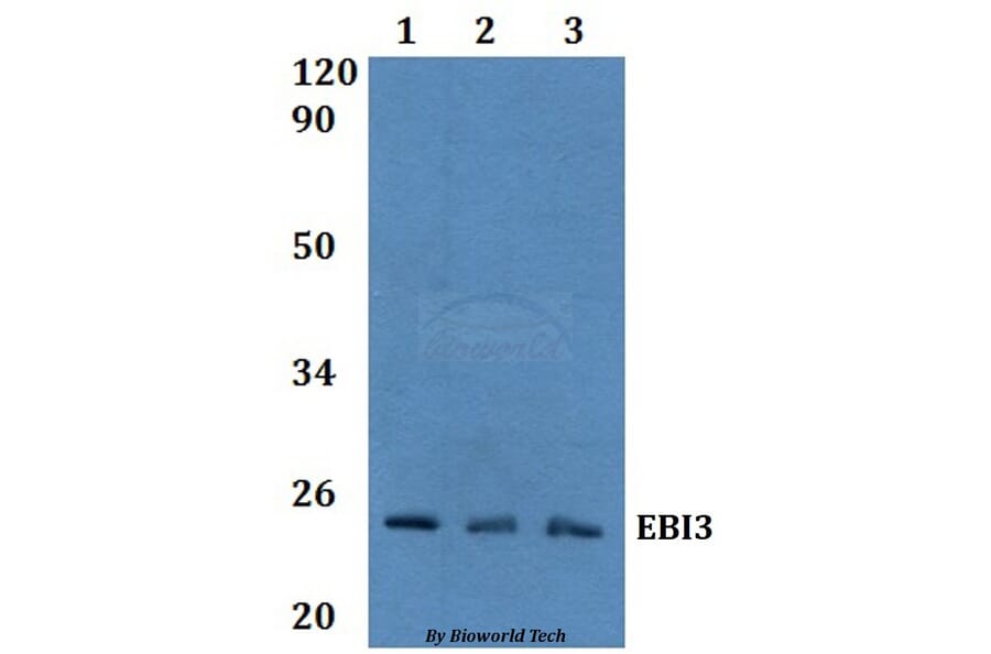 Anti-EBI3 Antibody from Bioworld Technology (BS60974) - Antibodies.com