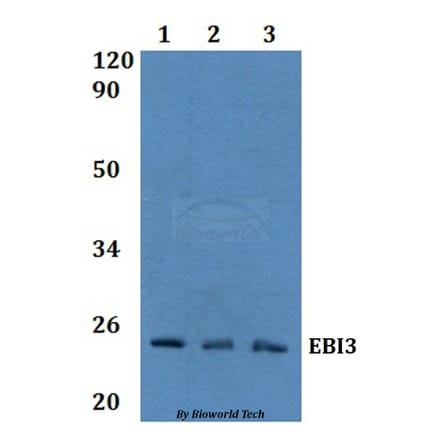 Anti-EBI3 Antibody from Bioworld Technology (BS60974) - Antibodies.com