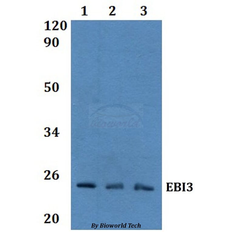 Anti-EBI3 Antibody from Bioworld Technology (BS60974) - Antibodies.com