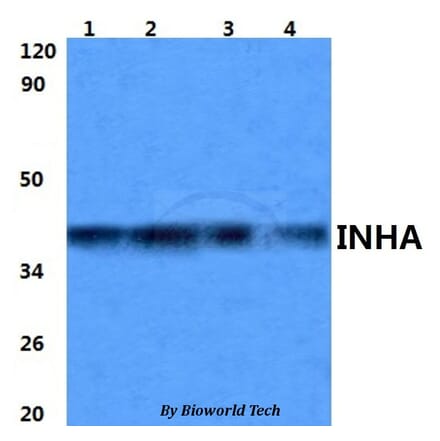 Anti-INHA Antibody from Bioworld Technology (BS60979) - Antibodies.com