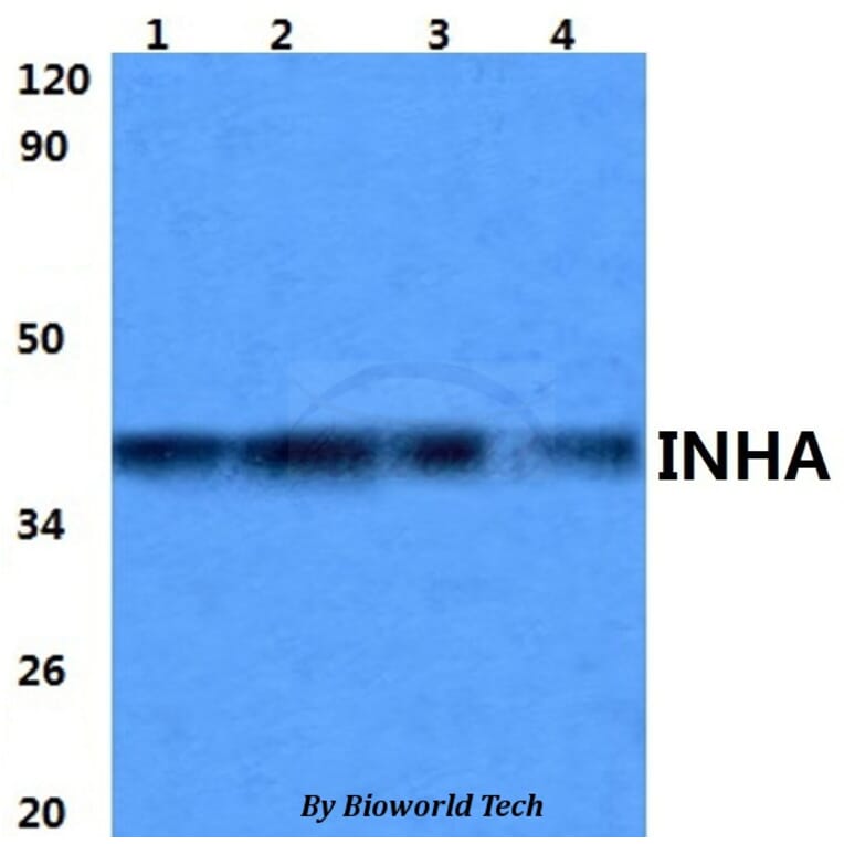 Anti-INHA Antibody from Bioworld Technology (BS60979) - Antibodies.com