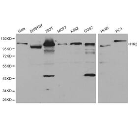Anti-Hexokinase-2 Antibody from Bioworld Technology (BS6098) - Antibodies.com