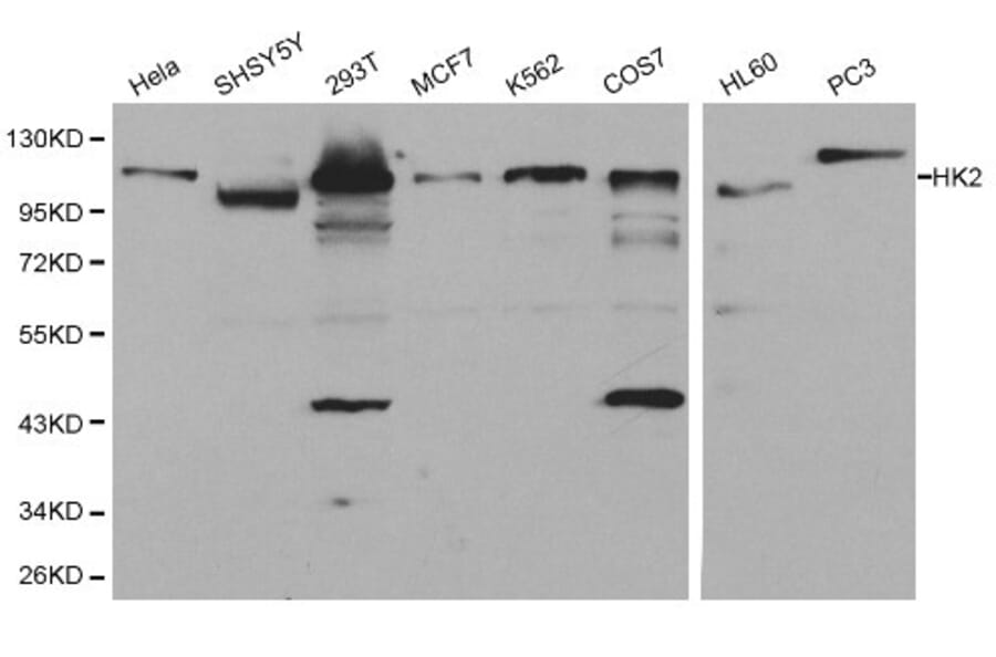 Anti-Hexokinase-2 Antibody from Bioworld Technology (BS6098) - Antibodies.com
