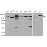 Anti-Hexokinase-2 Antibody from Bioworld Technology (BS6098) - Antibodies.com