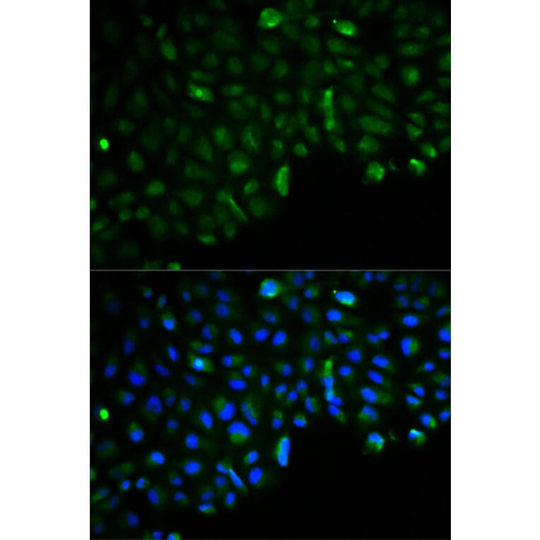 Anti-Hexokinase-2 Antibody from Bioworld Technology (BS6098) - Antibodies.com