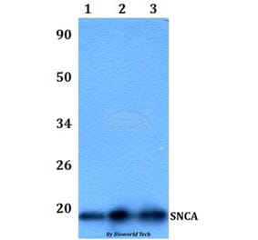 Anti-SNCA Antibody from Bioworld Technology (BS60989) - Antibodies.com