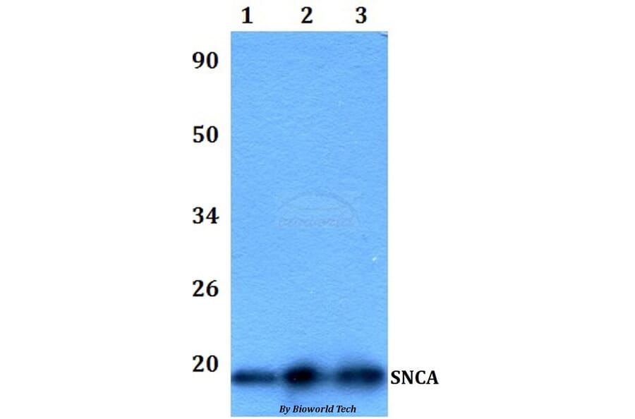 Anti-SNCA Antibody from Bioworld Technology (BS60989) - Antibodies.com