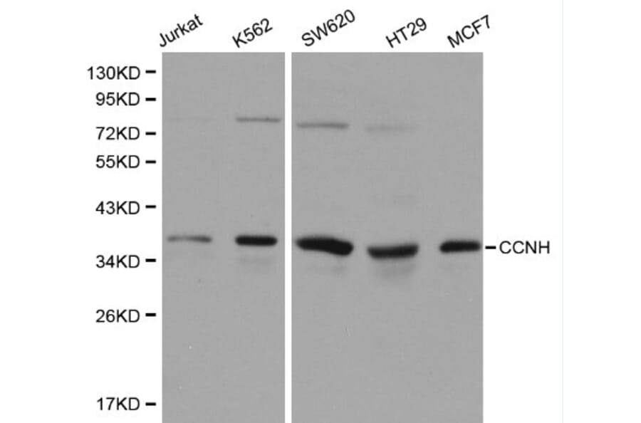 Anti-Cyclin H Antibody from Bioworld Technology (BS6099) - Antibodies.com