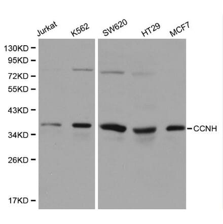 Anti-Cyclin H Antibody from Bioworld Technology (BS6099) - Antibodies.com