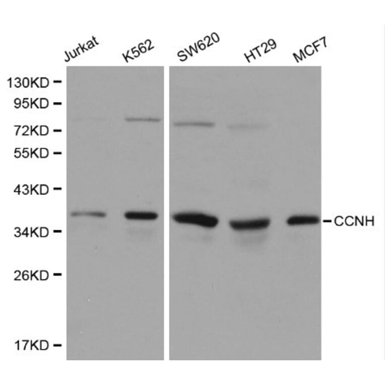 Anti-Cyclin H Antibody from Bioworld Technology (BS6099) - Antibodies.com