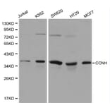 Anti-Cyclin H Antibody from Bioworld Technology (BS6099) - Antibodies.com