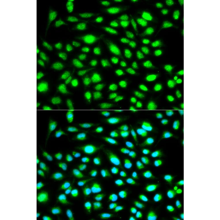 Anti-Cyclin H Antibody from Bioworld Technology (BS6099) - Antibodies.com