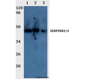 Anti-SERPINB3/4 Antibody from Bioworld Technology (BS60990) - Antibodies.com