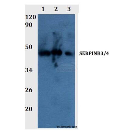 Anti-SERPINB3/4 Antibody from Bioworld Technology (BS60990) - Antibodies.com